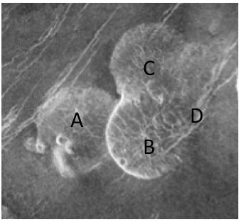 Black and white photo of Venus's Alpha Regio region, with three circular structures labeled A, B, and C.  A linear structure is labeled D. B overlies A and C; D cuts across B.  A and C do not meet.